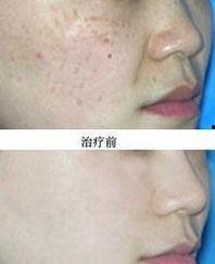 福州美容院最新爆料,美容行业最新潮流与秘密大曝光 第1张 福州美容院最新爆料,美容行业最新潮流与秘密大曝光 第1张